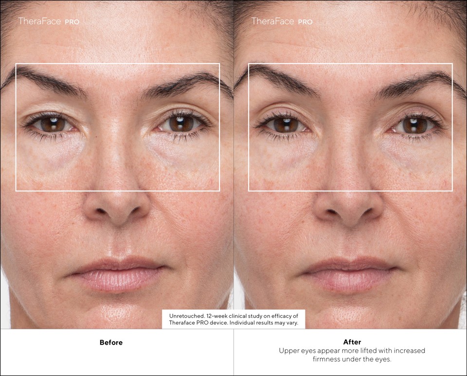 Therabody - TheraFace Pro Nero, la soluzione più avanzata per la salute del viso