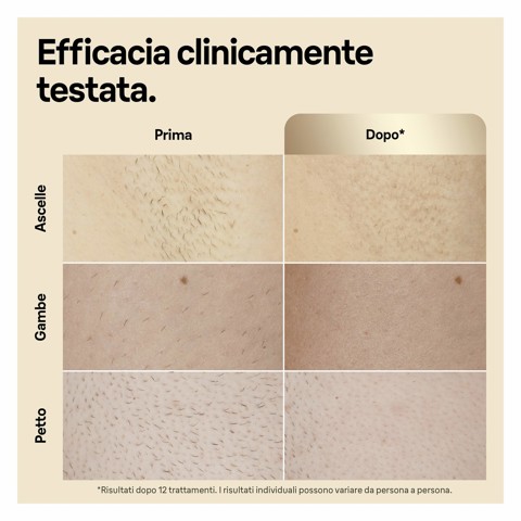 Braun Silk-expert Pro Epilatore Luce Pulsata Silk·expert Pro 5, Epilazione A Casa Tua, Con Custodia, Rasoio Donna Venus, 4 Testine, PL5356