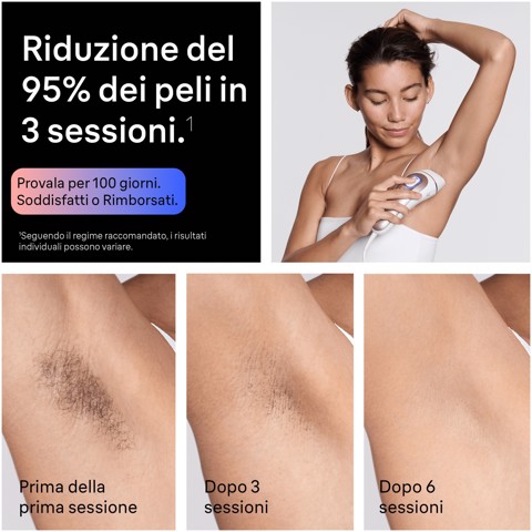 Braun Silk-expert Skin I·Expert Epilatore A Luce Pulsata Smart, Epilazione a Casa, Con App Gratuita, 2 Testine, PL7211